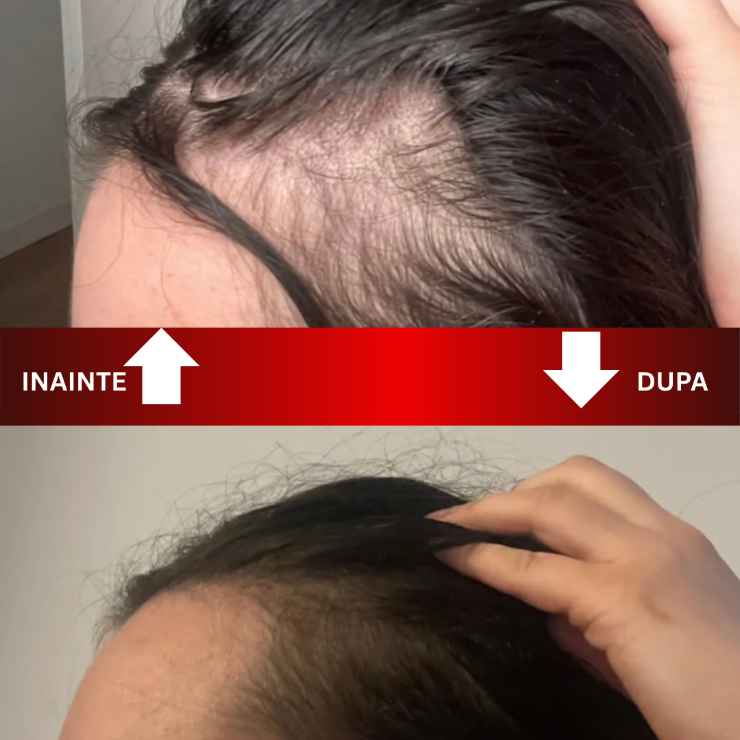 Capsule cu vitamine pentru păr – frumusețe concentrată în fiecare picătură